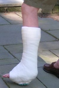 walking cast applied after personal injury